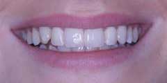 Cosmetic dentistry - St Dunstan's Dental Practice and Referral Centre